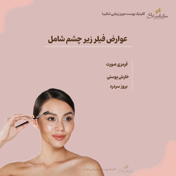 عوارض فیلر زیر چشم 