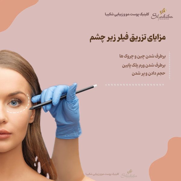 مزایای تزریق فیلر زیر چشم