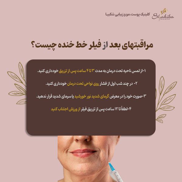 مراقبتهای بعد از فیلر خط خنده