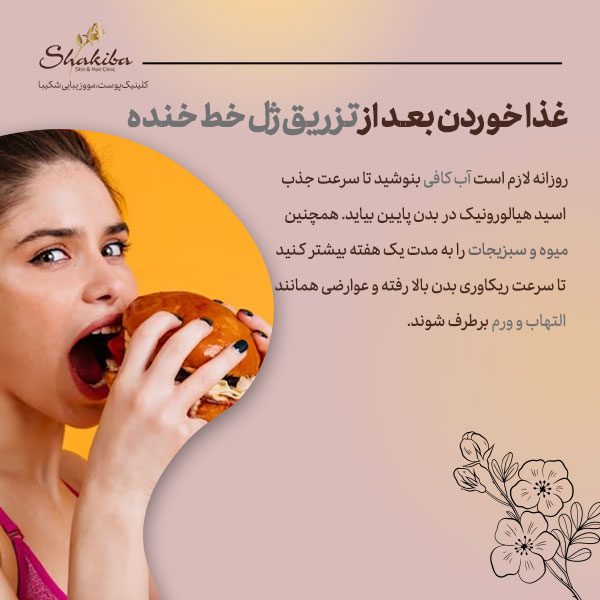 غذا خوردن بعد از تزریق ژل خط خنده
