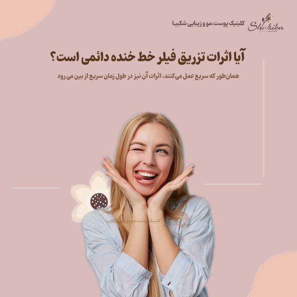 اثرات تزریق فیلر خط خنده