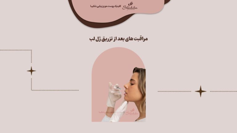 نکات مراقبت های بعد از تزریق ژل لب