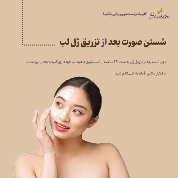 شستن صورت بعد از تزریق ژل لب