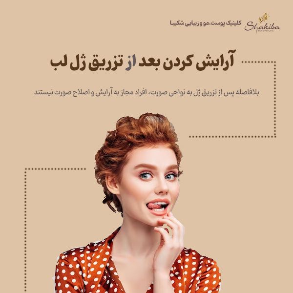 آرایش کردن بعد از تزریق ژل لب