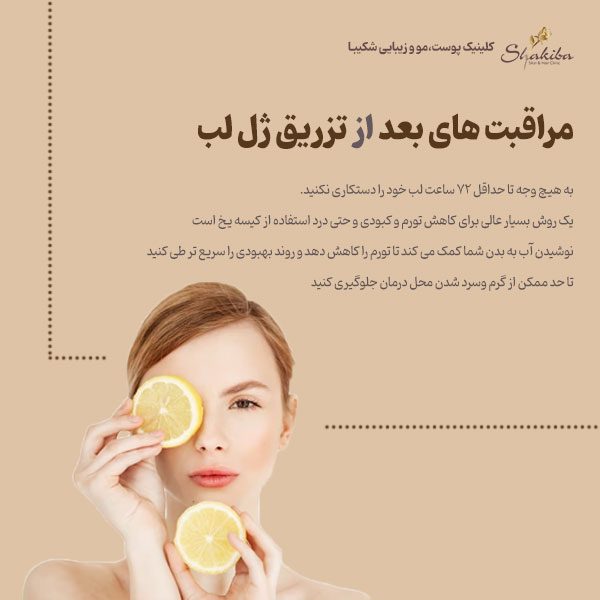 مراقبت های بعد از تزریق ژل لب
