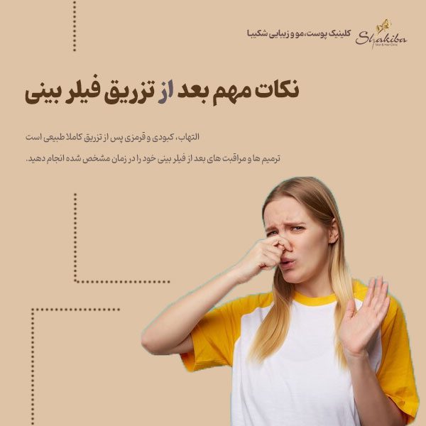 نکات مهم بعد از تزریق فیلر بینی