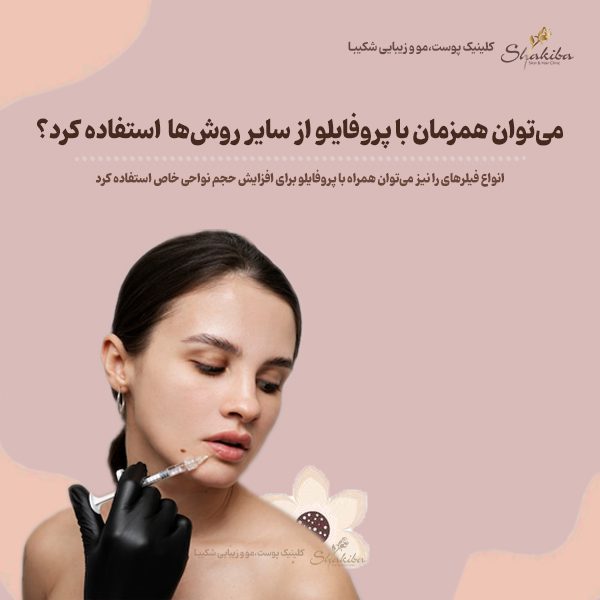 آیا می‌توان همزمان با پروفایلو از سایر روش‌ها نیز استفاده کرد؟