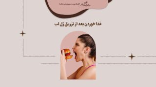 غذا خوردن بعد از تزریق ژل لب