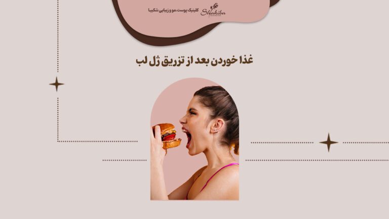 غذا خوردن بعد از تزریق ژل لب