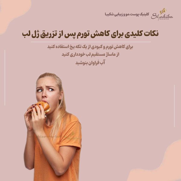 کاهش تورم پس از تزریق ژل لب