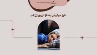 خوابیدن بعد از تزریق ژل لب