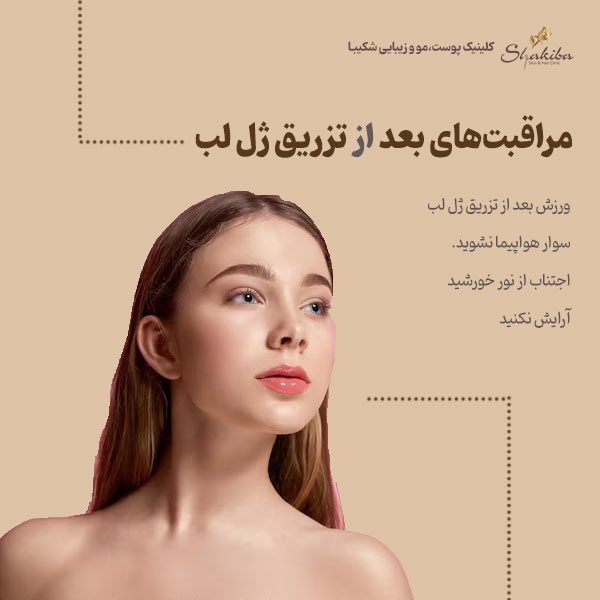 مراقبت‌های بعد از تزریق ژل لب