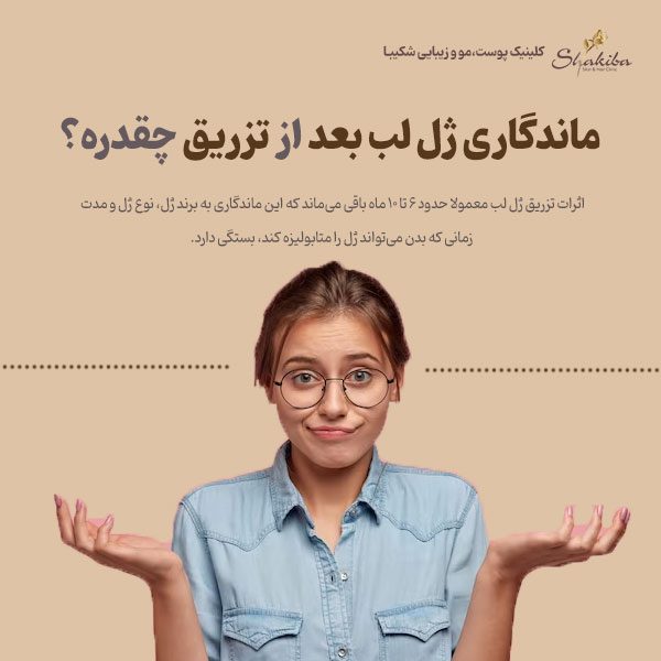 ماندگاری ژل لب بعد