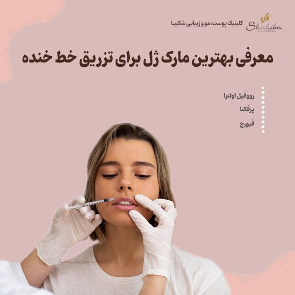 معرفی بهترین مارک ژل برای تزریق خط خنده