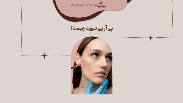 پی آر پی صورت چیست