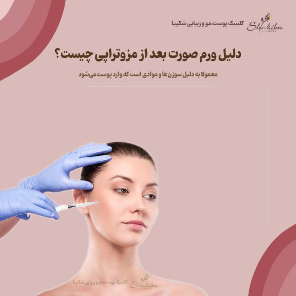 دلیل ورم صورت بعد از مزوتراپی