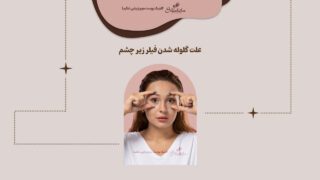 علت گلوله شدن فیلر زیر چشم