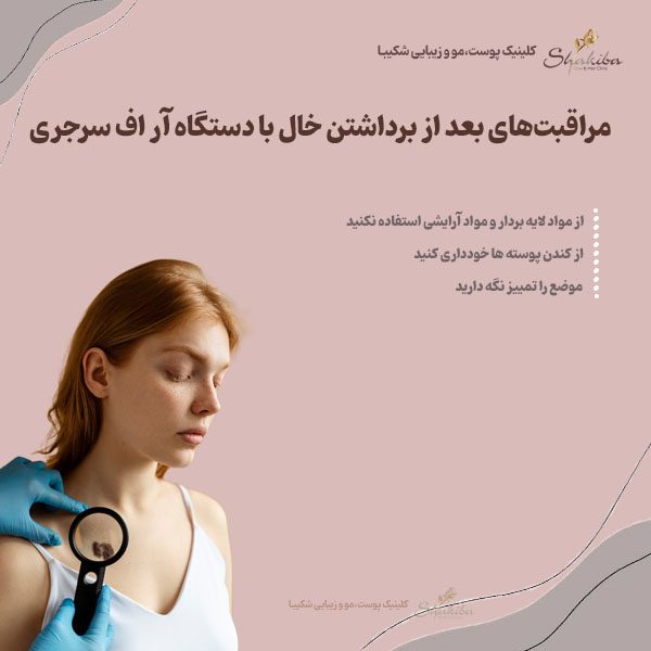 مراقبت‌های بعد از برداشتن خال 
