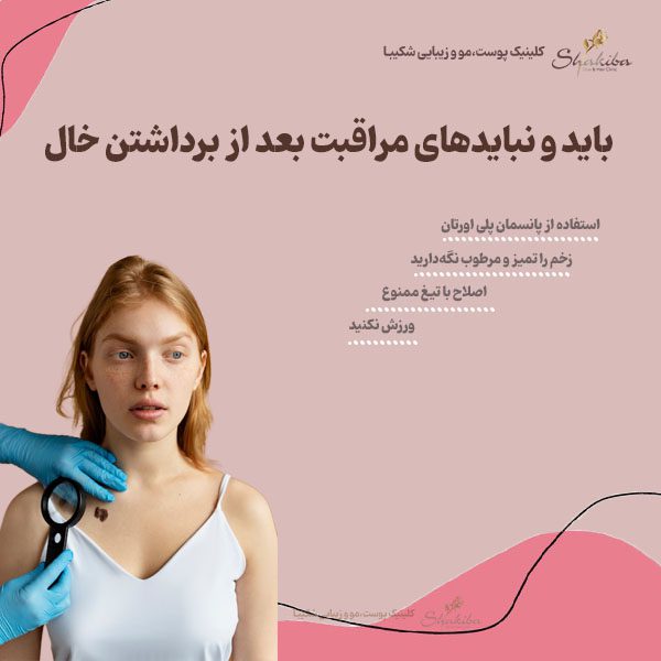  مراقبت بعد از برداشتن خال
