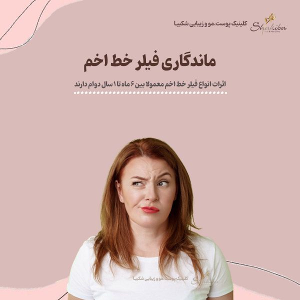 ماندگاری فیلر خط اخم