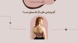 روش برداشتن خال با آر اف