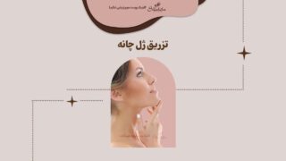 تزریق ژل چانه