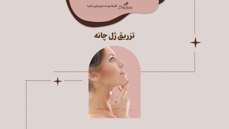 تزریق ژل چانه