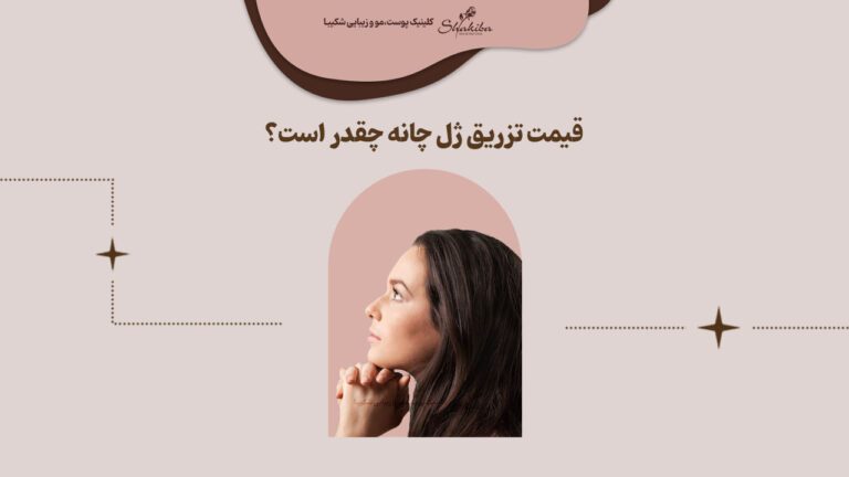 قیمت تزریق ژل چانه 1402