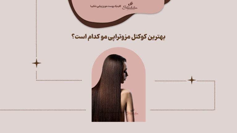 بهترین کوکتل مزوتراپی مو کدام است