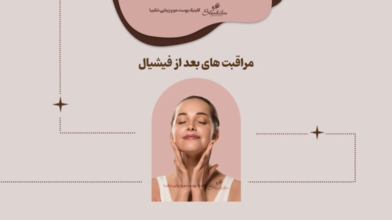 مراقبت های بعد از فیشیال صورت