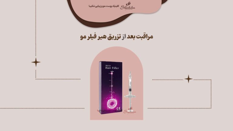 مراقبت بعد از تزریق هیر فیلر مو