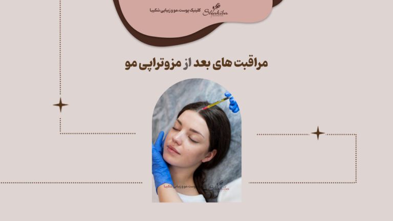 مراقبت بعد از مزوتراپی مو