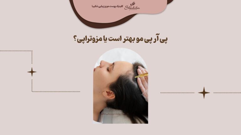 پی آر پی مو بهتر است یا مزوتراپی