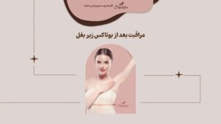 مراقبت های بعد از بوتاکس زیر بغل