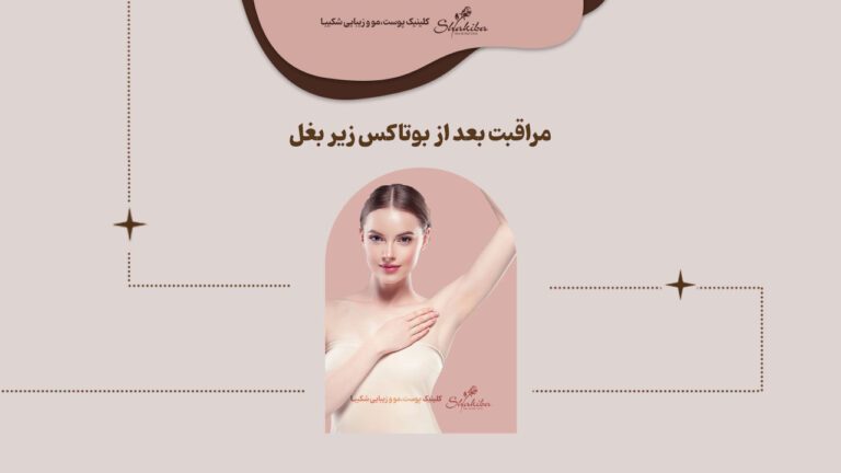 مراقبت های بعد از بوتاکس زیر بغل