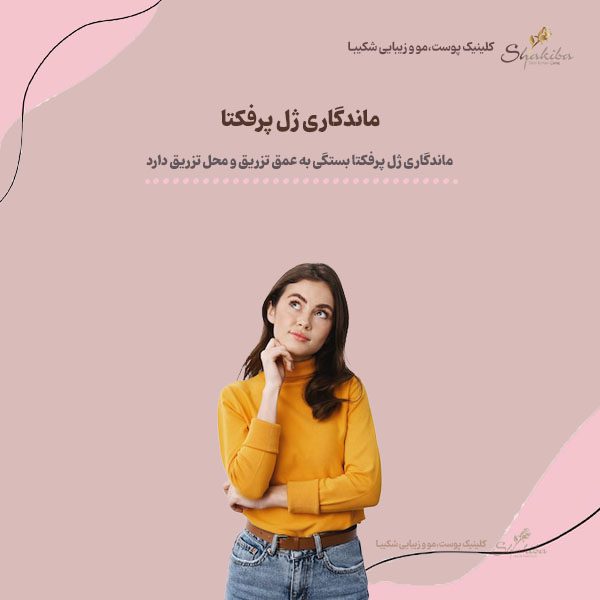ماندگاری ژل پرفکتا