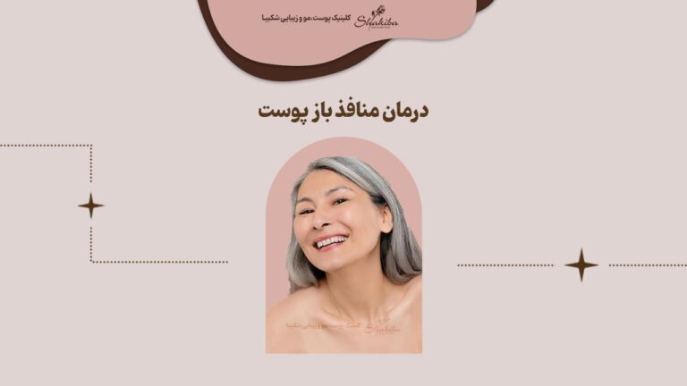 درمان منافذ باز پوست