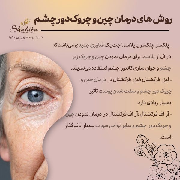 روش‌های درمان چین و چروک دور چشم