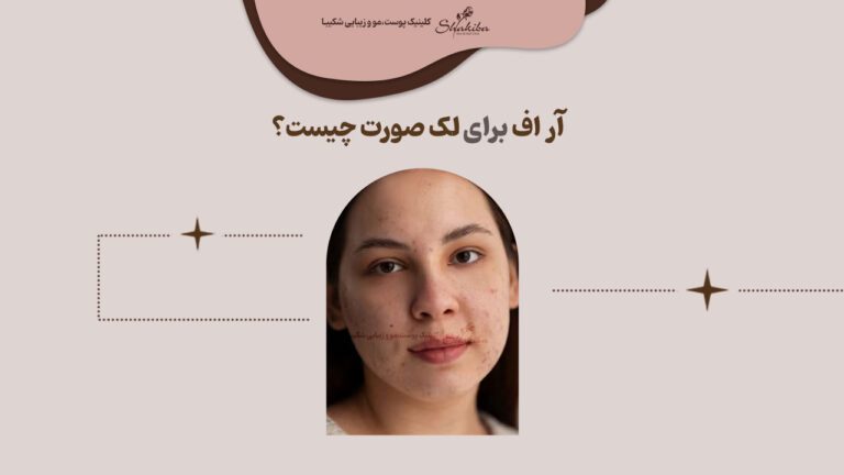 آر اف برای لک صورت چیست