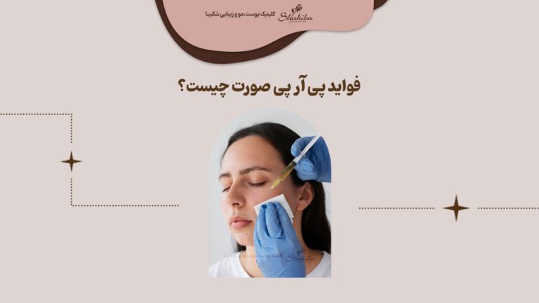 فواید پی آر پی صورت چیست
