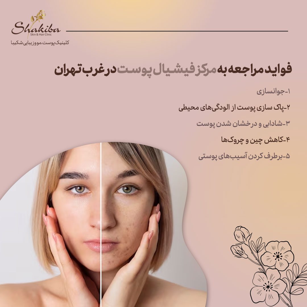 بهترین مرکز فیشیال پوست در غرب تهران