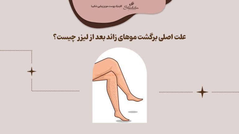 علت اصلی برگشت موهای زائد بعد از لیزر