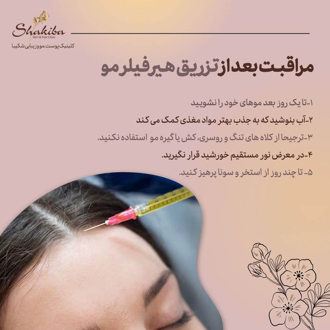 مراقبت بعد از تزریق هیر فیلر مو