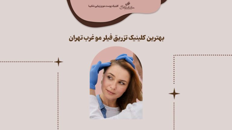 بهترین کلینیک تزریق فیلر مو غرب تهران