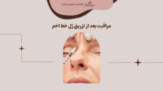 مراقبت بعد از تزریق ژل خط اخم