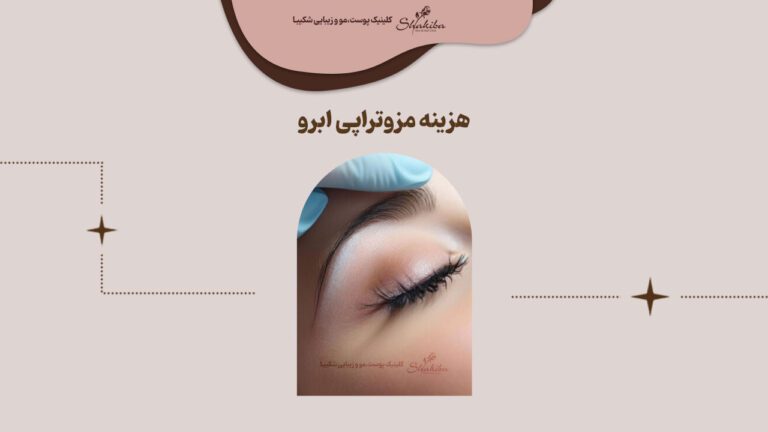 قیمت مزوتراپی ابرو