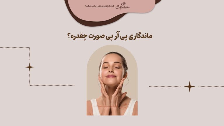 ماندگاری پی آر پی صورت چقدره