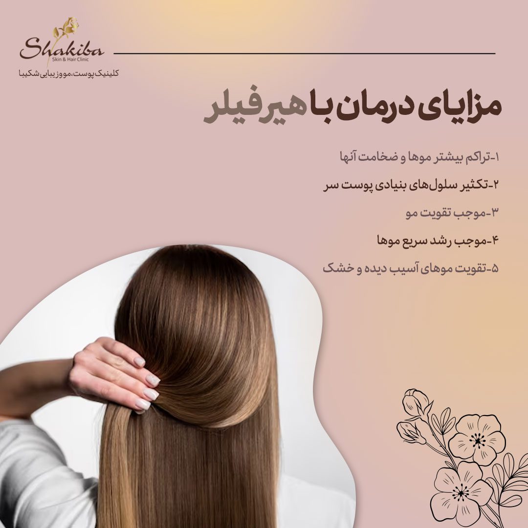 مزایای هیر فیلر
