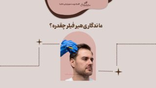 ماندگاری هیر فیلر چقدره