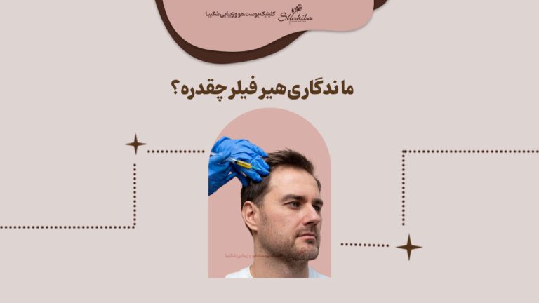 ماندگاری هیر فیلر چقدره